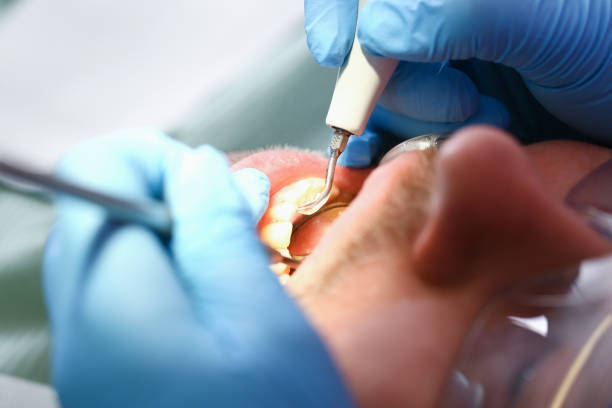 Best Emergency Dental Extractions in Lavalette, WV