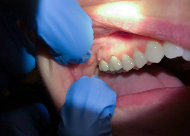Best Urgent Dental Care for Toothache in Lavalette, WV