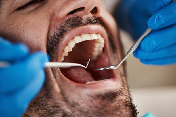Best Emergency Dental Care for Abscessed Tooth in Lavalette, WV