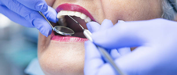 Best Emergency Dentist for Knocked-Out Tooth in Lavalette, WV