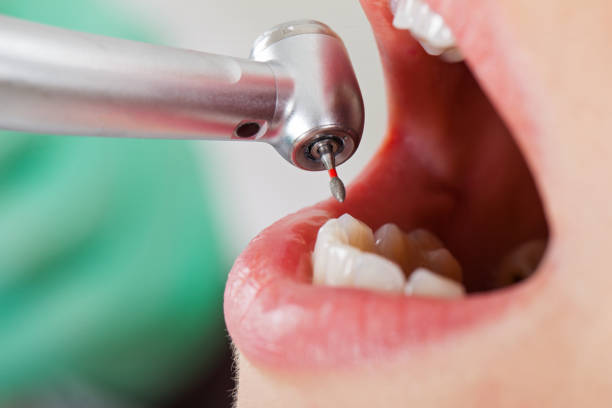 Best Pediatric Emergency Dentist in Lavalette, WV